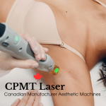 Key Questions to Ask Before Purchasing Laser Hair Removal Equipment