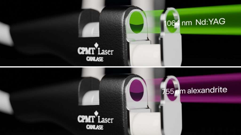 Power of Alexandrite and Nd: YAG Lasers Machines