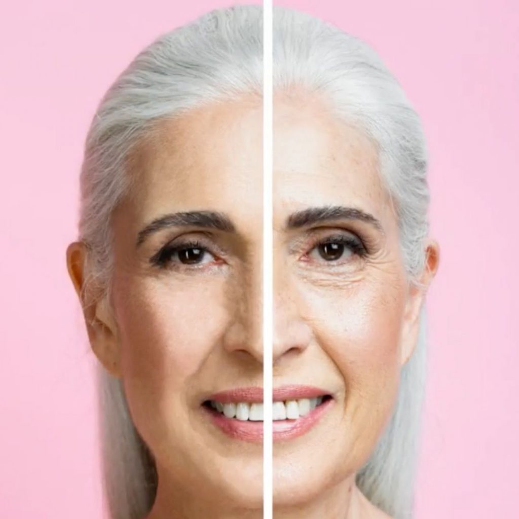 Skin Tightening | Facial