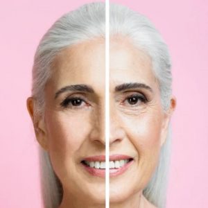 Skin Tightening | Facial